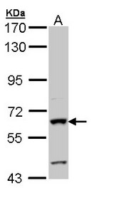 ALPI / Alkaline Phosphatase Antibody - Sample (30 ug of whole cell lysate). A: Hep G2 . 7.5% SDS PAGE. ALPI / Alkaline Phosphatase antibody diluted at 1:1000.