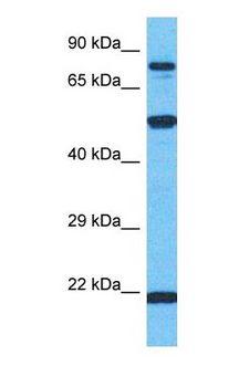 ALPI / Alkaline Phosphatase Antibody - Western blot of PPBI Antibody with human HeLa Whole Cell lysate.  This image was taken for the unconjugated form of this product. Other forms have not been tested.