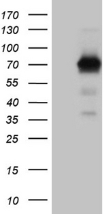 ALPI / Alkaline Phosphatase Antibody - HEK293T cells were transfected with the pCMV6-ENTRY control. (Left lane) or pCMV6-ENTRY ALPI. (Right lane) cDNA for 48 hrs and lysed. Equivalent amounts of cell lysates. (5 ug per lane) were separated by SDS-PAGE and immunoblotted with anti-ALPI. (1:2000)
