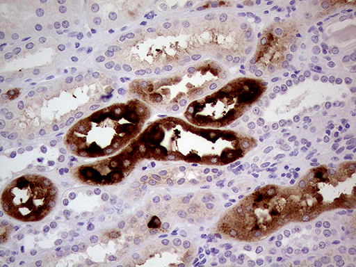 ALPI / Alkaline Phosphatase Antibody - Immunohistochemical staining of paraffin-embedded Human Kidney tissue within the normal limits using anti-ALPI mouse monoclonal antibody. (Heat-induced epitope retrieval by 1mM EDTA in 10mM Tris buffer. (pH8.5) at 120°C for 3 min. (1:500)