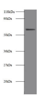 ALPI / Alkaline Phosphatase Antibody - Western blot of Intestinal-type alkaline phosphatase antibody at 2ug/ml + 293T whole cell lysate. Secondary: Goat polyclonal to Rabbit IgG at 1:10000 dilution. Predicted band size: 58 kDa. Observed band size: 58 kDa.  This image was taken for the unconjugated form of this product. Other forms have not been tested.