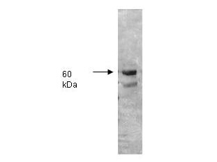 ALPI / Alkaline Phosphatase Antibody - Anti-Alkaline Phosphatase Antibody - Western Blot. Both the antiserum and IgG fractions of anti-Alkaline Phosphatase (Human Intestine) are shown to detect under reducing conditions of SDS-PAGE the 60000 dalton enzyme in cellular extracts. Approximately 10 ug of total protein is loaded per lane. A 1:5000 dilution of the primary antibody is used followed by detection using HRP Goat-a-Rabbit IgG [H&L] (LS-C60884) diluted 1:4000 and color development using 4-CN substrate until sufficient color develops. Other detection systems will yield similar results.