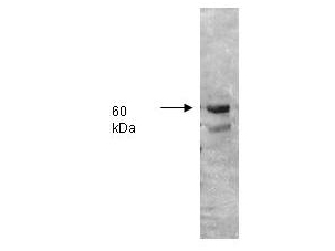 ALPI / Alkaline Phosphatase Antibody - Both the antiserum and IgG fractions of anti-Alkaline Phosphatase (Human Intestine) are shown to detect under reducing conditions of SDS-PAGE the 60,000 dalton enzyme in cellular extracts. Approximately 10 ug of total protein is loaded per lane. A 1:5,000 dilution of the primary antibody is used followed by detection using HRP Goat-a-Rabbit IgG [H&L] (611-1302) diluted 1:4,000 and color development using 4-CN substrate until sufficient color develops. Other detection systems will yield similar results.