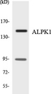 ALPK1 Antibody - Western blot analysis of the lysates from 293 cells using ALPK1 antibody.