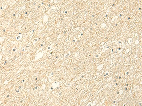 ALPK1 Antibody - Immunohistochemistry of paraffin-embedded Human brain tissue  using ALPK1 Polyclonal Antibody at dilution of 1:50(×200)