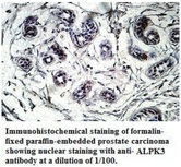 ALPK3 Antibody