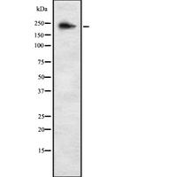 ALPK3 Antibody - Western blot analysis of ALPK3 using K562 whole cells lysates
