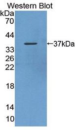 ALPL / Alkaline Phosphatase Antibody - Western Blot; Sample: Recombinant protein.