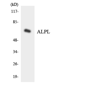 ALPL / Alkaline Phosphatase Antibody - Western blot of the lysates from Jurkat cells using ALPL antibody.