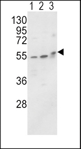 ALPL / Alkaline Phosphatase Antibody - Western blot of ALPL Antibody in MCF-7(lane 1),HL-60 cell line(lane 2) and mouse brain tissue(lane 3) lysates (35 ug/lane). ALPL (arrow) was detected using the purified antibody.