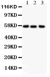 ALPL / Alkaline Phosphatase Antibody - All lanes: Anti ALPL at 0.5 ug/ml. Lane 1: Human Placenta Tissue Lysate at 50 ug. Lane 2: HT1080 Whole Cell Lysate at 40 ug. Lane 3: JURKAT Whole Cell Lysate at 40 ug. Predicted band size: 57 kD. Observed band size: 57 kD.