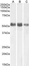 ALPL / Alkaline Phosphatase Antibody - Goat anti-ALPL (aa42-53) Antibody (0.1µg/ml) staining of Human Kidney (A), Lung (B) and Adrenal Gland (C) lysates (35µg protein in RIPA buffer). Primary incubation was 1 hour. Detected by chemiluminescencence.