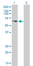 ALPL / Alkaline Phosphatase Antibody - Western Blot analysis of ALPL expression in transfected 293T cell line by ALPL monoclonal antibody (M01), clone 4H1.Lane 1: ALPL transfected lysate(57.3 KDa).Lane 2: Non-transfected lysate.