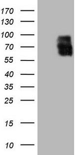 ALPL / Alkaline Phosphatase Antibody - HEK293T cells were transfected with the pCMV6-ENTRY control. (Left lane) or pCMV6-ENTRY ALPL. (Right lane) cDNA for 48 hrs and lysed