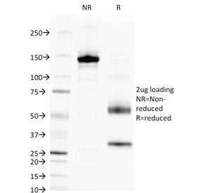 ALPL / Alkaline Phosphatase Antibody - SDS-PAGE analysis of purified, BSA-free ALPL antibody (clone V17.1) as confirmation of integrity and purity.