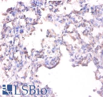ALPL / Alkaline Phosphatase Antibody - Immunohistochemistry of paraffin-embedded human lung using ALPL / Alkaline Phosphatase antibody at dilution of 1:100.  This image was taken for the unconjugated form of this product. Other forms have not been tested.