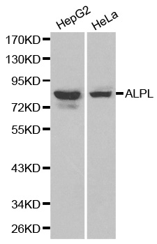 ALPL / Alkaline Phosphatase Antibody - Western blot analysis of HepG2 cell and Hela cell lysate.