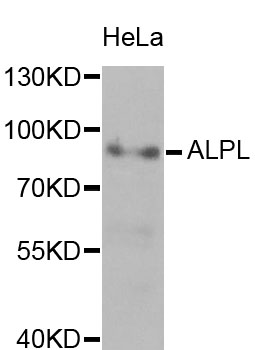 ALPL / Alkaline Phosphatase Antibody - Western blot analysis of extracts of HeLa cells, using ALPL antibody at 1:1000 dilution. The secondary antibody used was an HRP Goat Anti-Rabbit IgG (H+L) at 1:10000 dilution. Lysates were loaded 25ug per lane and 3% nonfat dry milk in TBST was used for blocking. An ECL Kit was used for detection and the exposure time was 60s.