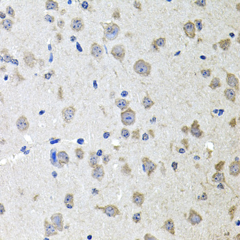ALPL / Alkaline Phosphatase Antibody - Immunohistochemistry of paraffin-embedded mouse brain using ALPL antibodyat dilution of 1:100 (40x lens).