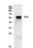 ALPL / Alkaline Phosphatase Antibody - Western Blot analysis of extracts from MCF7 cells using ALPL Antibody.