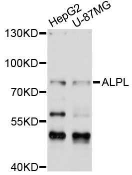 ALPL / Alkaline Phosphatase Antibody - Western blot analysis of extracts of various cell lines, using ALPL antibody at 1:1000 dilution. The secondary antibody used was an HRP Goat Anti-Rabbit IgG (H+L) at 1:10000 dilution. Lysates were loaded 25ug per lane and 3% nonfat dry milk in TBST was used for blocking. An ECL Kit was used for detection and the exposure time was 30s.