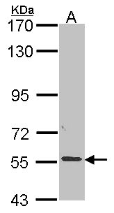 ALPPL2 Antibody - Sample (30 ug of whole cell lysate). A: A549. 7.5% SDS PAGE. ALPPL2 antibody. ALPPL2 antibody diluted at 1:1000.