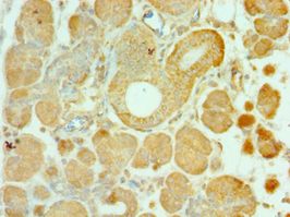 ALS2 / Alsin Antibody - Immunohistochemistry of paraffin-embedded human pancreas using antibody at 1:100 dilution.