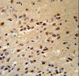 ALS2 / Alsin Antibody - ALS2 Antibody (RB18853) IHC of formalin-fixed and paraffin-embedded human brain tissue followed by peroxidase-conjugated secondary antibody and DAB staining.