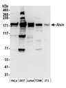 ALS2 / Alsin Antibody - Detection of human and mouse Alsin by western blot. Samples: Whole cell lysate (50 µg) from HeLa, HEK293T, Jurkat, mouse TCMK-1, and mouse NIH 3T3 cells prepared using NETN lysis buffer. Antibodies: Affinity purified rabbit anti-Alsin antibody used for WB at 0.1 µg/ml. Detection: Chemiluminescence with an exposure time of 30 seconds.