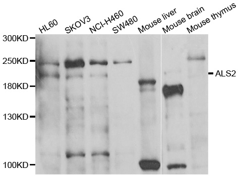 ALS2 / Alsin Antibody - Western blot analysis of extracts of various cell lines.