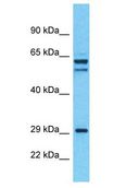 ALS2CL Antibody - ALS2CL antibody Western Blot of 293T. Antibody dilution: 1 ug/ml.  This image was taken for the unconjugated form of this product. Other forms have not been tested.