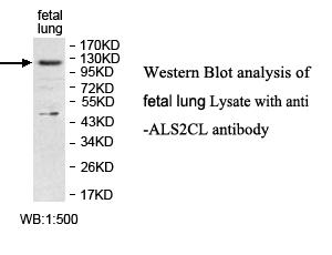 ALS2CL Antibody