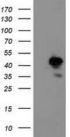 ALS2CR1 / NIF3L1 Antibody - HEK293T cells were transfected with the pCMV6-ENTRY control (Left lane) or pCMV6-ENTRY NIF3L1 (Right lane) cDNA for 48 hrs and lysed. Equivalent amounts of cell lysates (5 ug per lane) were separated by SDS-PAGE and immunoblotted with anti-NIF3L1.