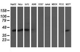 ALS2CR1 / NIF3L1 Antibody - Western blot of extracts (35ug) from 9 different cell lines by using anti-NIF3L1 monoclonal antibody (HepG2: human; HeLa: human; SVT2: mouse; A549: human; COS7: monkey; Jurkat: human; MDCK: canine; PC12: rat; MCF7: human).