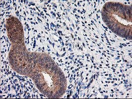 ALS2CR1 / NIF3L1 Antibody - IHC of paraffin-embedded Human endometrium tissue using anti-NIF3L1 mouse monoclonal antibody. (Heat-induced epitope retrieval by 10mM citric buffer, pH6.0, 100C for 10min).