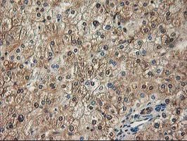ALS2CR1 / NIF3L1 Antibody - IHC of paraffin-embedded Human liver tissue using anti-NIF3L1 mouse monoclonal antibody.