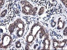 ALS2CR1 / NIF3L1 Antibody - IHC of paraffin-embedded Human breast tissue using anti-NIF3L1 mouse monoclonal antibody.