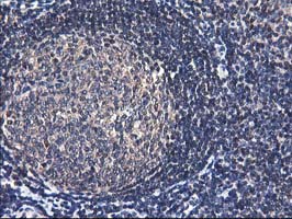 ALS2CR1 / NIF3L1 Antibody - IHC of paraffin-embedded Human tonsil using anti-NIF3L1 mouse monoclonal antibody.