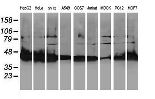 ALS2CR1 / NIF3L1 Antibody - Western blot of extracts (35 ug) from 9 different cell lines by using anti-NIF3L1 monoclonal antibody.