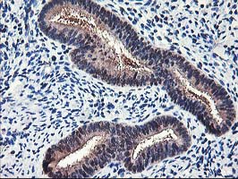 ALS2CR1 / NIF3L1 Antibody - IHC of paraffin-embedded Human endometrium tissue using anti-NIF3L1 mouse monoclonal antibody.