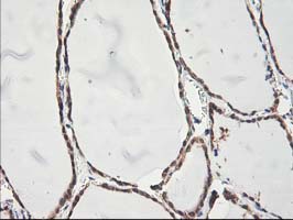 ALS2CR1 / NIF3L1 Antibody - IHC of paraffin-embedded Human thyroid tissue using anti-NIF3L1 mouse monoclonal antibody.