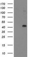 ALS2CR1 / NIF3L1 Antibody - HEK293T cells were transfected with the pCMV6-ENTRY control (Left lane) or pCMV6-ENTRY NIF3L1 (Right lane) cDNA for 48 hrs and lysed. Equivalent amounts of cell lysates (5 ug per lane) were separated by SDS-PAGE and immunoblotted with anti-NIF3L1.