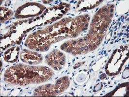 ALS2CR1 / NIF3L1 Antibody - IHC of paraffin-embedded Human Kidney tissue using anti-NIF3L1 mouse monoclonal antibody.