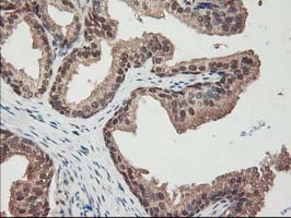 ALS2CR1 / NIF3L1 Antibody - IHC of paraffin-embedded Human prostate tissue using anti-NIF3L1 mouse monoclonal antibody.