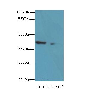 ALS2CR1 / NIF3L1 Antibody - Western blot. All lanes: NIF3L1 antibody at 0.2 ug/ml. Lane 1: 293T whole cell lysate. Lane 2: MDA-MB-231 whole cell lysate. Secondary Goat polyclonal to Rabbit IgG at 1:10000 dilution. Predicted band size: 42 kDa. Observed band size: 42 kDa.
