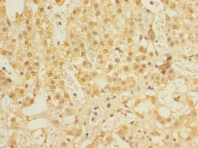 ALS2CR1 / NIF3L1 Antibody - Immunohistochemistry of paraffin-embedded human adrenal gland tissue using antibody at dilution of 1:100.