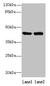 ALS2CR1 / NIF3L1 Antibody - Western blot All lanes: NIF3L1 antibody at 0.2µg/ml Lane 1: 293T whole cell lysate Lane 2: MDA-MB-231 whole cell lysate Secondary Goat polyclonal to rabbit IgG at 1/10000 dilution Predicted band size: 42, 39, 33 kDa Observed band size: 42 kDa