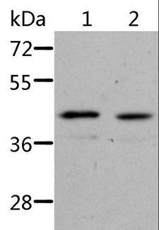 ALS2CR1 / NIF3L1 Antibody - Western blot analysis of Jurkat cell and human fetal kidney tissue, using NIF3L1 Polyclonal Antibody at dilution of 1:500.
