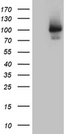 ALS2CR11 Antibody - HEK293T cells were transfected with the pCMV6-ENTRY control. (Left lane) or pCMV6-ENTRY ALS2CR11. (Right lane) cDNA for 48 hrs and lysed