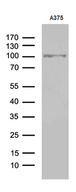 ALS2CR11 Antibody - Western blot analysis of extracts. (35ug) from A375 cell line by using anti-ALS2CR11 monoclonal antibody. (1:500)